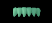 Cod.C12Facing : 10x  wax facings-bridges,  SMALL, Aligned, TOOTH 43-33, compatible with Cod.A12Lingual,TOOTH 43-33 for long-term provisionals preparation